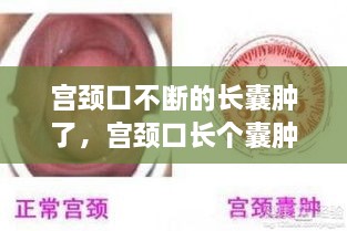 宫颈口不断的长囊肿了，宫颈口长个囊肿 