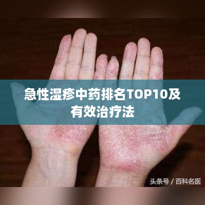 急性湿疹中药排名TOP10及有效治疗法