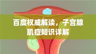 百度权威解读，子宫腺肌症知识详解