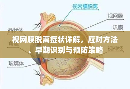 视网膜脱离症状详解，应对方法、早期识别与预防策略