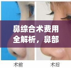 鼻综合术费用全解析，鼻部整形价格一览