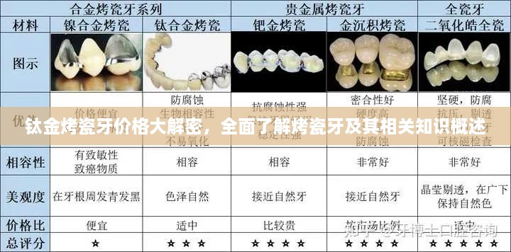 钛金烤瓷牙价格大解密，全面了解烤瓷牙及其相关知识概述