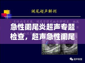 急性阑尾炎超声专题检查，超声急性阑尾炎的诊断标准 