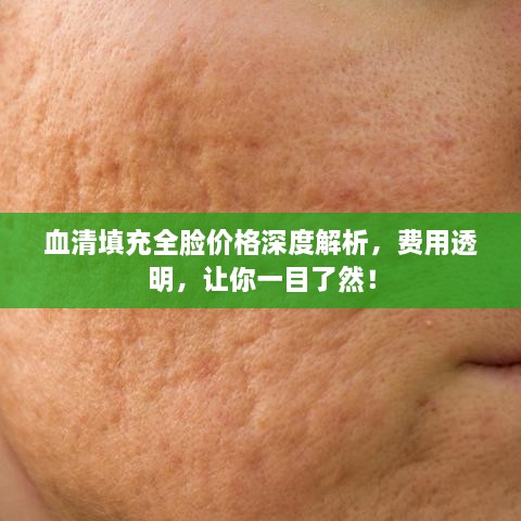 血清填充全脸价格深度解析，费用透明，让你一目了然！